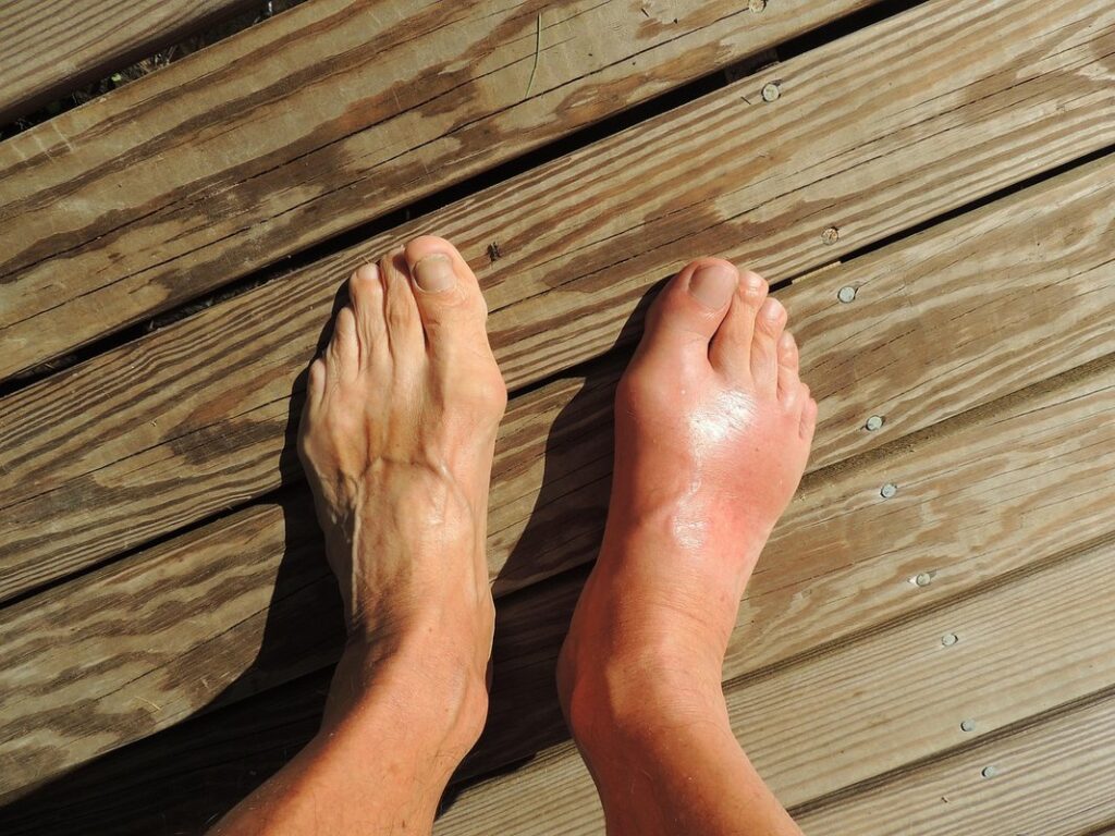 postpartum ankle swelling
