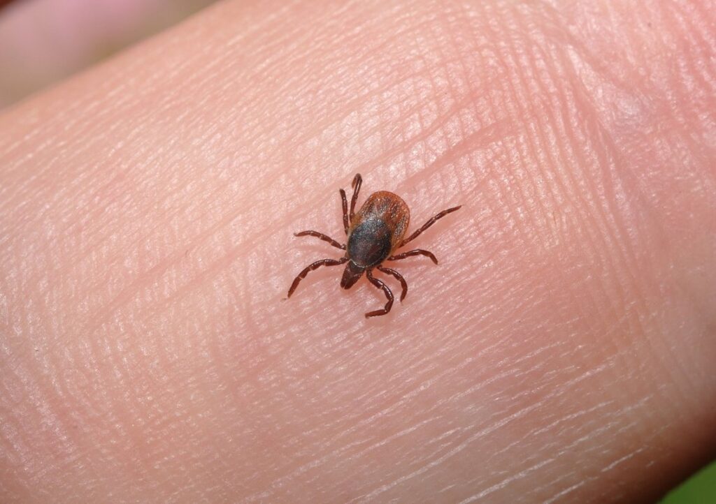 head lice treatment steps for parents